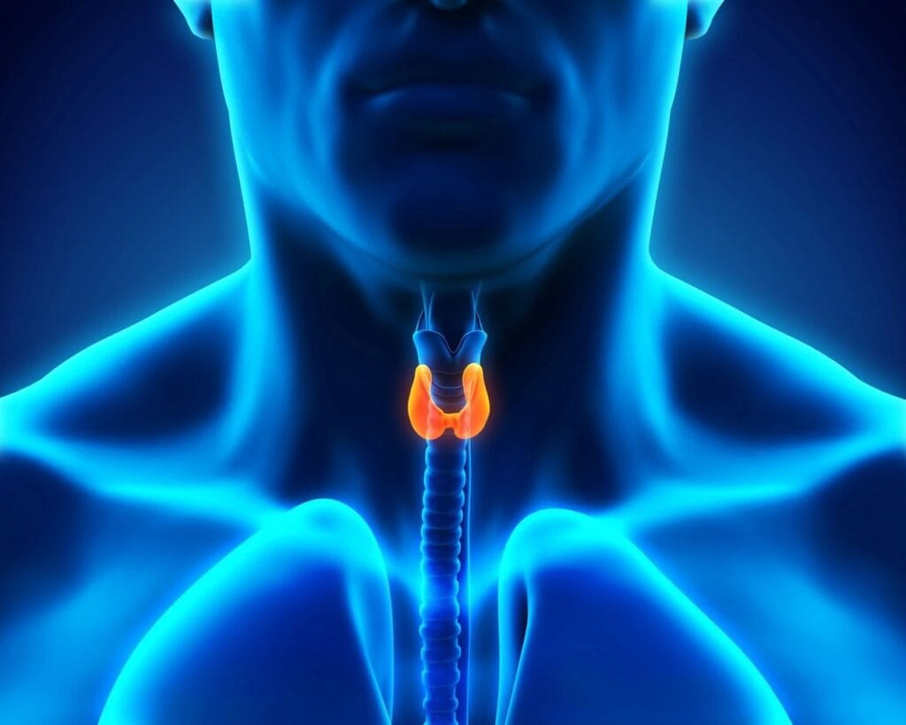 Hypothyroidism